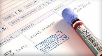 92 новых случая ВИЧ-инфекции выявлено на Вологодчине в текущем году - vologda-poisk.ru - Вологодская обл. - Вологда - Череповец