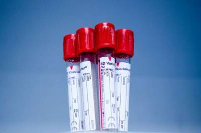 Медики опровергли влияние группы крови на риск заражения коронавирусом - lenta.ua