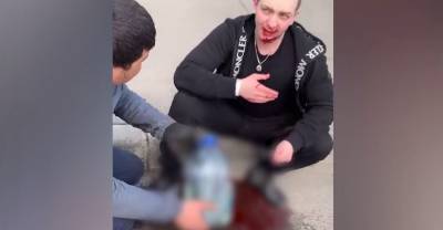 Сломал челюсть и помял несколько авто: рэпер Yung Trappa на машине каршеринга попал в серьёзное ДТП — видео - reendex.ru - Санкт-Петербург