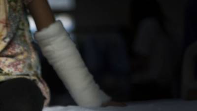 Любительница секса из Апатит попала в больницу с переломом костей - polit.info