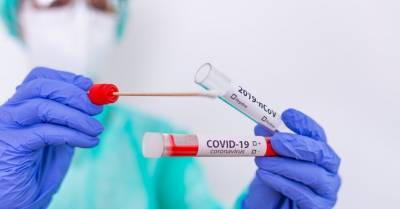 В Литве выявлено 726 новых случаев Covid-19 за сутки, в Эстонии — 543 - rus.delfi.lv - Эстония - Литва - Латвия
