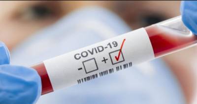 В Украине новый "рекорд" по суточному приросту больных COVID-19 - vchaspik.ua