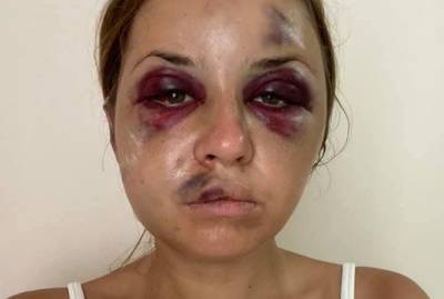 Анастасия Луговая - Напавший на журналистку в поезде "Мариуполь - Киев" мужчина умер - kp.ua - Киев - Мариуполь