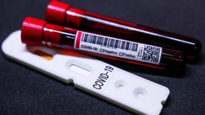 В Украине обнаружили более 12 тысяч новых случаев COVID-19: статистика по регионам - vchaspik.ua - Киев