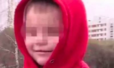 Мальчик получил химический ожог глаз в супермаркете - gubdaily.ru - Москва - Зеленоград