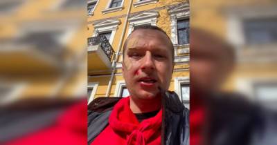 В центре Киева избили телеведущего Майкла Щура (видео) - focus.ua - Киев