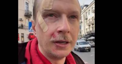 В центре Киева из-за замечания избили известного ведущего Майкла Щура - tsn.ua - Киев