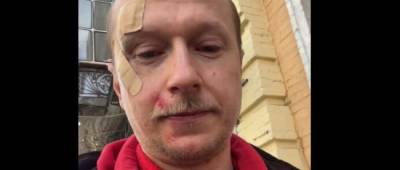 Пешеходы против самокатов: в Киеве напали на телеведущего Майкла Щура - w-n.com.ua - Киев