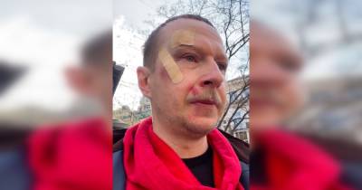 Избиение Майкла Щура в Киеве: ведущий отказался от экспертизы и признал свою неправоту - focus.ua - Украина - Киев