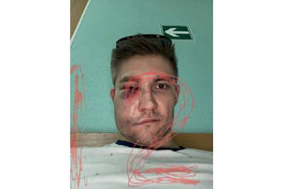 Александр Паль - Кевин Антипов - Появились фото избитого актером Палем хоккеиста - lenta.ru - Москва