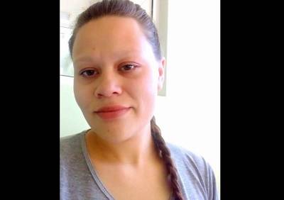 Рязанка, на которую рухнула люстра в больнице, вынула из головы четыре осколка - ya62.ru - Рязанская обл.