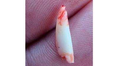 Акула сломала зуб об голову мужчины: он ловил рыбу под водой - фото, видео 18+ - 24tv.ua - Юар