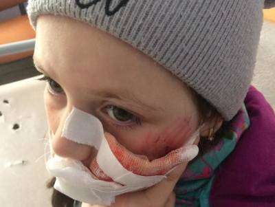 9-летняя девочка из Нижнего Одеса после нападения собаки направлена в Ухтинскую горбольницу - komiinform.ru