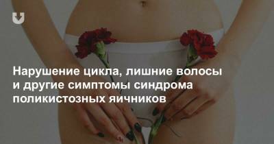 Нарушение цикла, лишние волосы и другие симптомы синдрома поликистозных яичников - news.tut.by