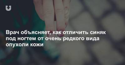 Врач объясняет, как отличить синяк под ногтем от очень редкого вида опухоли кожи - news.tut.by