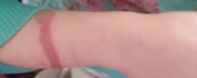 Жительница Ростовской области держала 8-летнюю дочь на привязи - runews24.ru - Ростовская обл. - Новошахтинск