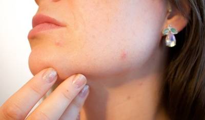 После коронавируса заболевания кожи могут стать хроническими - mirnov.ru