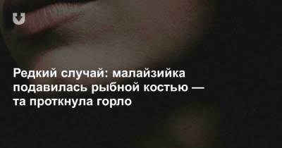 Редкий случай: малайзийка подавилась рыбной костью — та проткнула горло - news.tut.by