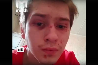 Московского рэпера побрили, избили и бросили в костер, пока он "спал на лавочке" - rupor.info