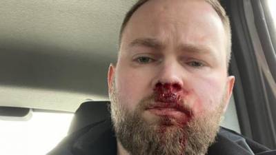 Блогер - Петербургского блогера Илью Бронского избили после его рассказа о жизни с ВИЧ - piter.tv - Санкт-Петербург