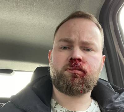 Юрий Дудь - На блогера из Санкт-Петербурга напали после его интервью о жизни с ВИЧ - readovka.ru - Санкт-Петербург