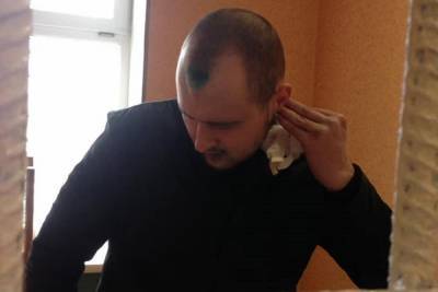Отбывающий срок за убийство ФСБшника россиянин зашил себе рот - mk.ru - Курган