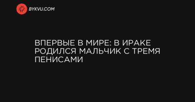 Впервые в мире: в Ираке родился мальчик с тремя пенисами - bykvu.com - Ирак
