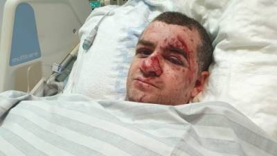 "Я очнулся под обломками": в квартире Эдуарда из Ашкелона взорвалась ракета - vesty.co.il - Ашкелон