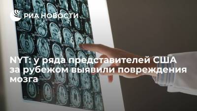 NYT: у ряда представителей США за рубежом выявили повреждения мозга - ria.ru - Китай - США - Вашингтон - New York - Куба - Европа