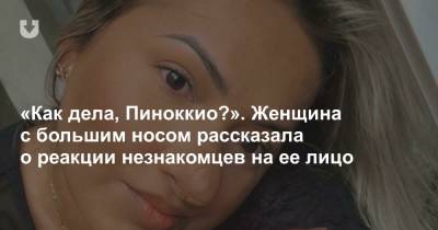 «Как дела, Пиноккио?». Женщина с большим носом рассказала о реакции незнакомцев на ее лицо - news.tut.by