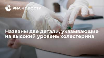 Названы две детали, указывающие на высокий уровень холестерина - ria.ru - Москва