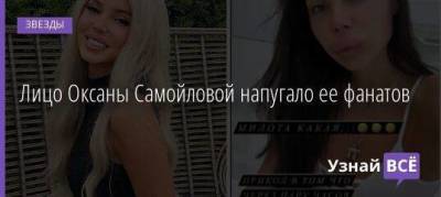 Оксана Самойлова - Лицо Оксаны Самойловой напугало ее фанатов - skuke.net