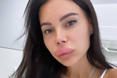 Оксана Самойлова - «Слабонервным не смотреть!» Самойлова с раздувшимися губами всех перепугала - skuke.net