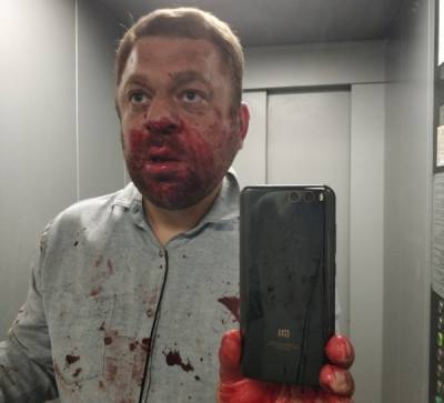 В Югорске избит бывший депутат гордумы Антон Пантин - nakanune.ru - Югорск - Нападение