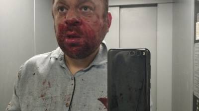 Елен Васильев - В Югорске совершено нападение на бывшего депутата - newdaynews.ru - Югра - Югорск