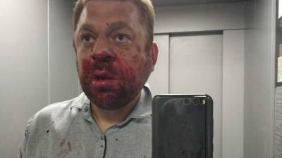 Сегодня утром в ХМАО избили депутата Антона Пантина - nashgorod.ru - Югра - Югорск