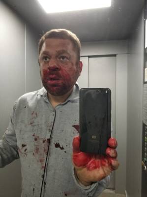 В ХМАО избили оппозиционного журналиста и общественного активиста - znak.com - Югра - Югорск