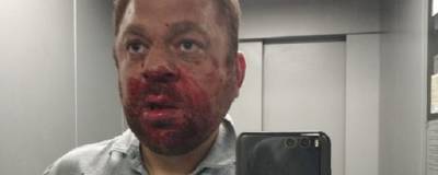 Оппозиционного журналиста и общественного активиста жестоко избили в Югре - runews24.ru - Югра - Югорск