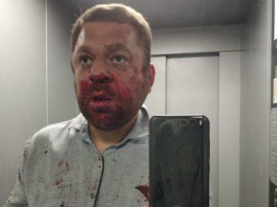 В ХМАО избит оппозиционный журналист - kasparov.ru - Югра - Югорск