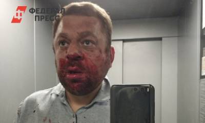 В Югорске оппозиционера Антона Пантина избил неизвестный в маске - fedpress.ru - Ханты-Мансийск - Югра - Югорск