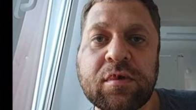 В Югорске неизвестный избил журналиста Антона Пантина - newizv.ru - Югорск