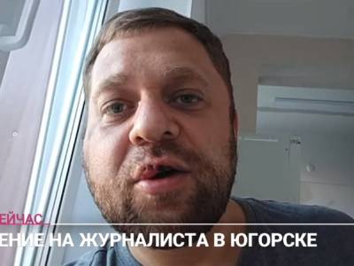 В ХМАО избили журналиста, критиковавшего местную власть - sobesednik.ru - Югра - Югорск
