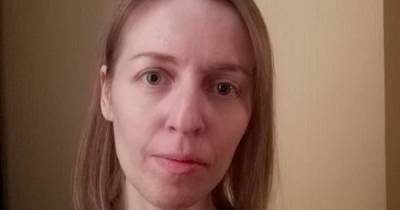 "Рак меня убивает": Юлия просит помочь ей пройти дорогостоящее лечение - tsn.ua - Коростень