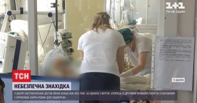 В Днепре мальчик получил ожоги более 40% кожи из-за неудачной попытки снять видео - tsn.ua - Полтавская обл. - Днепр