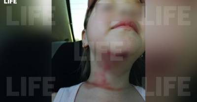 В Омской области шестилетняя девочка чуть не отрезала себе голову в зоопарке - reendex.ru - Омская обл.