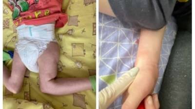 Издевательства над детьми-инвалидами. В самарском пансионате массово увольняется персонал - vesti.ru - Самара