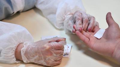 Ученые определили ранние признаки болезни Альцгеймера - iz.ru - Швеция