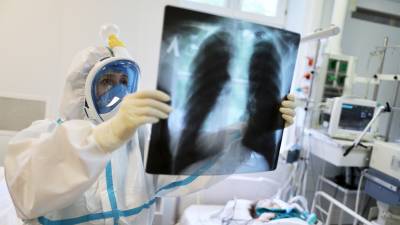 Николай Крючков - Иммунолог рассказал, когда можно вакцинироваться переболевшим коронавирусом - russian.rt.com