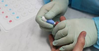 Швейцарские учёные изобрели тест, определяющий наличие антител к ковиду по капле крови - reendex.ru - Швейцария