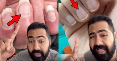 Врач на видео раскрыл, как по одному взгляду на ногти понять, мог ли пациент уже переболеть CoViD - reendex.ru
